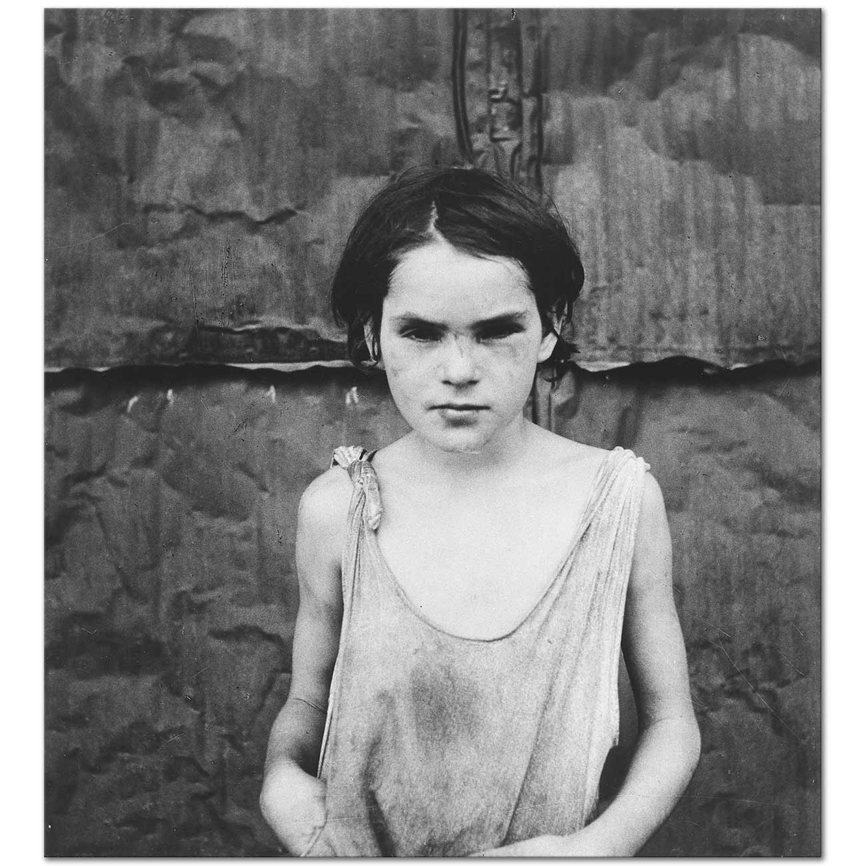 Dorothea Lange Damaged Child Art Print