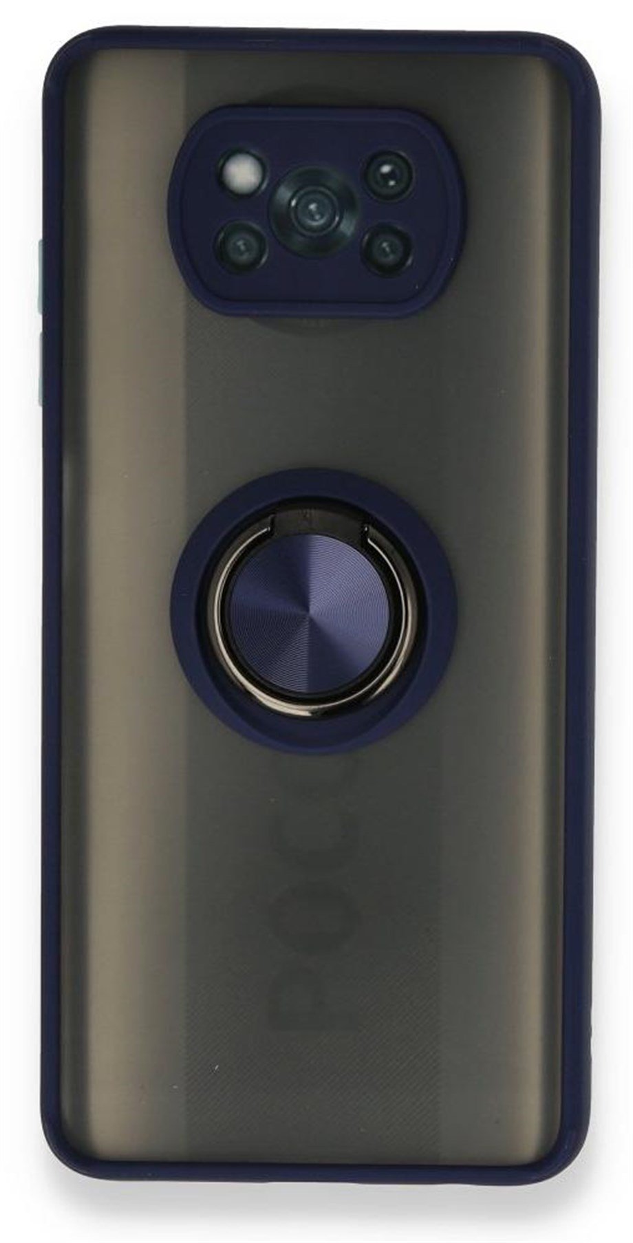 Xiaomi Poco X3 Yüzüklü Mamba