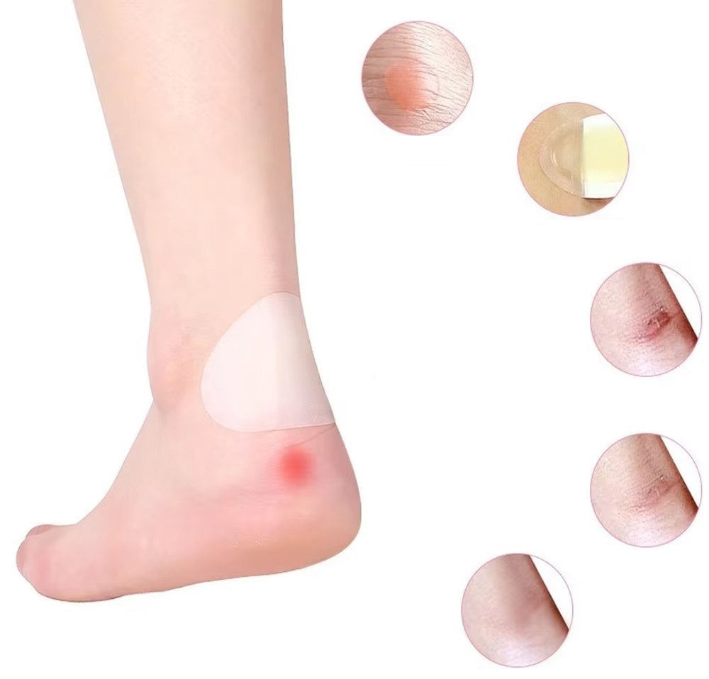 Sunup SN-25970 Blister Topuk Bandajı