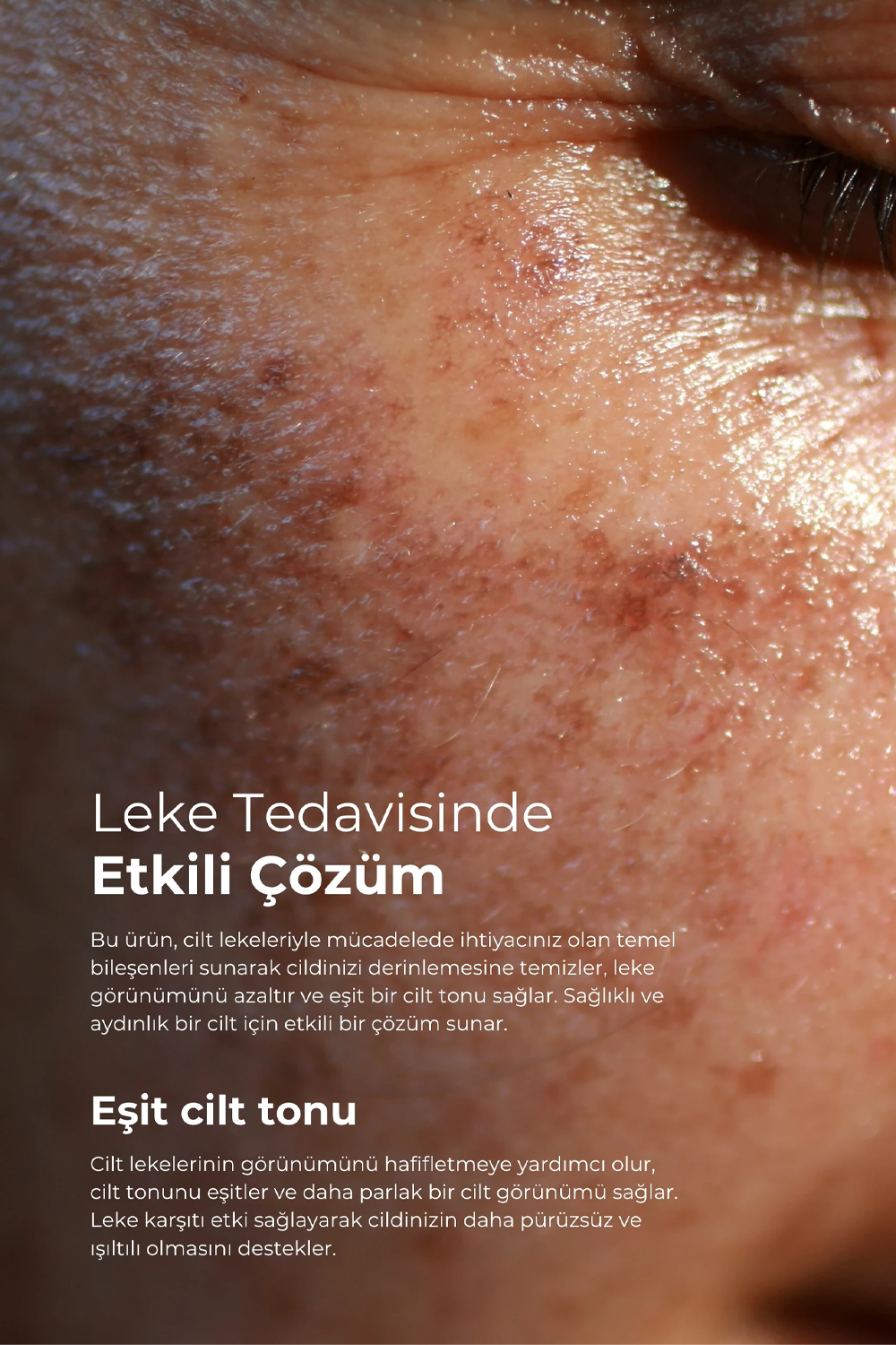 TTO Clinic Leke Kremi 75 ml | KozmovitalLeke BakımıTTOTTO Clinic Leke Kremi 75 ml