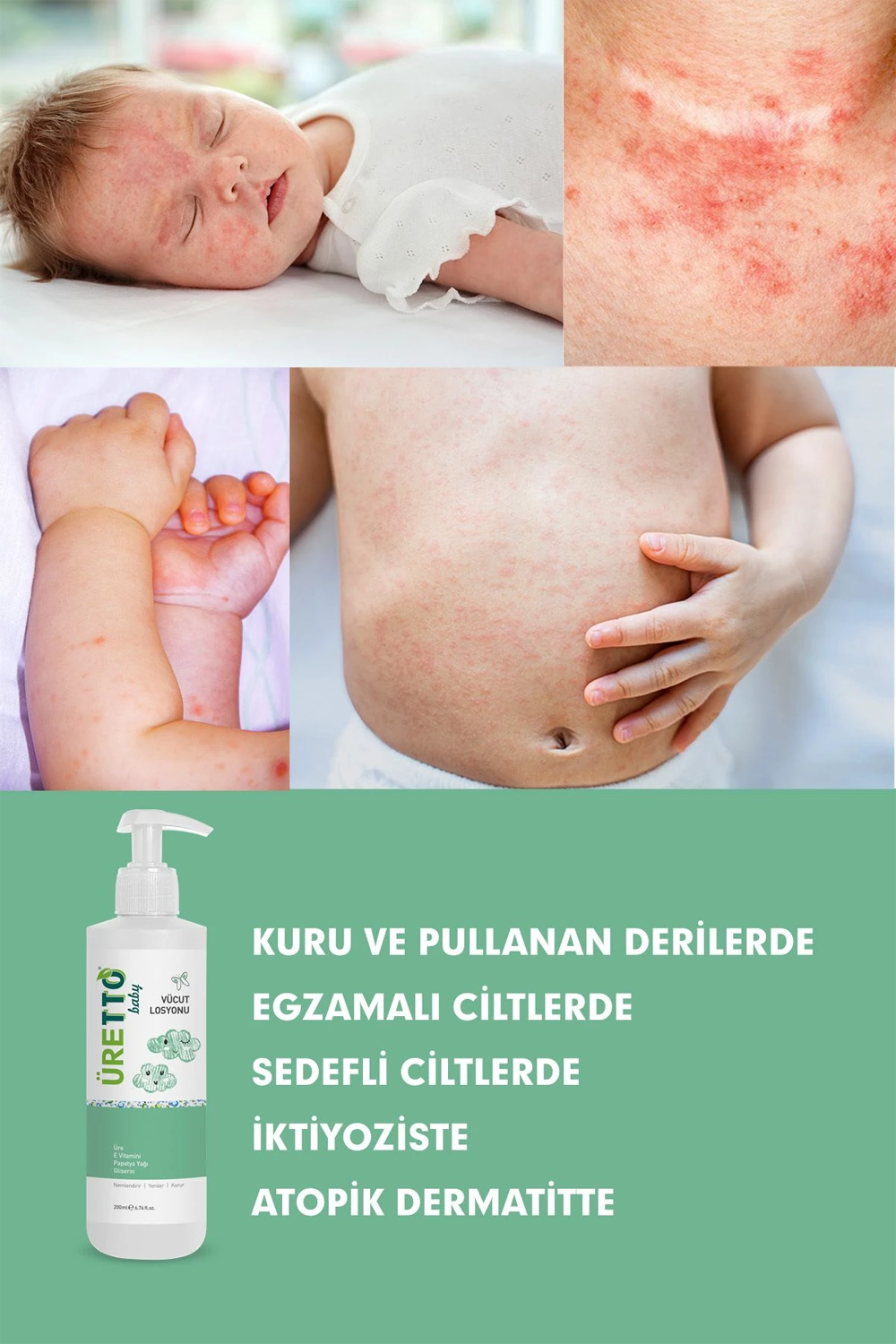 TTO Üretto Baby Vücut Losyonu 200 ml | KozmovitalBebek NemlendiricileriTTOTTO Üretto Baby Vücut Losyonu 200 ml