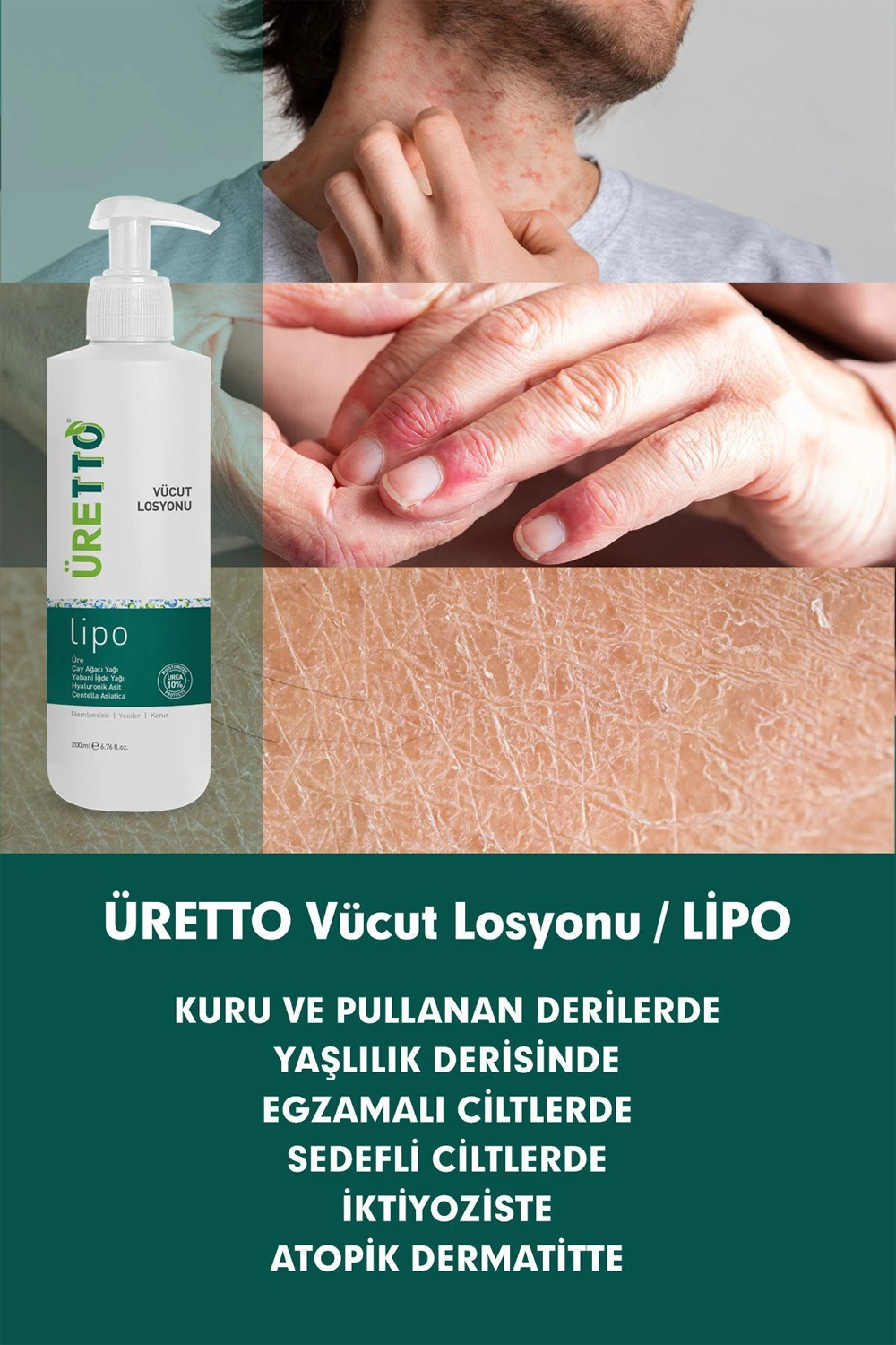 TTO Üretto Lipo Vücut Losyonu 200 ml | KozmovitalVücut NemlendiricileriTTOTTO Üretto Lipo Vücut Losyonu 200 ml