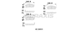 ON FREN BALATASI HYUNDAI ELANTRA 01-03 MATRIX 02-07 MATRIX 07->