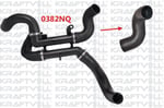 TURBO HORTUM C5 II C5 III P407 INTERCOLL RADYATORUN USTUNE GELEN (0382RX)