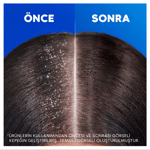 Head&Shoulders Şampuan 2'si 1 Arada Mentol Ferahlığı 625 ml