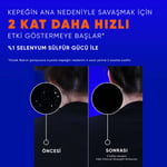 Head&Shoulders Şampuan Clinical Dry Scalp 400 ml
