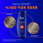 Head&Shoulders Şampuan Clinical Dry Scalp 400 ml