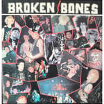 Broken Bones - Never Say Die 12