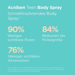 Acniben Body Spray 150 ml