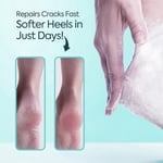 CLASYCARE Topuk Çatlağı Kremi – Kuru ve Çatlamış Topuklar için – E Vitamini ve Avokado Yağlı Topuk Kremi – Nasır, Sert ve Ölü Deriler için Nemlendirici Ayak Bakım Kremi – 100 ml