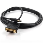 Dark Dk-Cb-Dvi 1.8M 24+1Pin Dvi Kablo (Erkek/Erkek