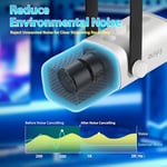 FIFINE Podcast Stüdyosu Akışı için USB XLR Mikrofon, Dinamik Mikrofon Oyun Bilgisayarı, PS4/5 Mac Mixer Ses Kartları için Sessiz Düğmeli - Seçenekler: Kol mikrofonu, Mikrofon, kollu mikrofon
