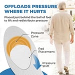Homergy Metatarsal Pedler - Kadınlar ve Erkekler için Ayak Pedleri - Ağrı Giderme için Ayak Pedleri - Metatarsalji için Ön Ayak Pedleri, Mortons Nöroma - 1/4 inç Kalınlık - 12 Adet