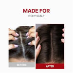 Kafein İçerikli Dökülme Karşıtı Saç Derisi Güçlendirici Tonik Kundal Scalp Tonic 100ml