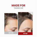 Kafein İçerikli Dökülme Karşıtı Saç Derisi Güçlendirici Tonik Kundal Scalp Tonic 100ml