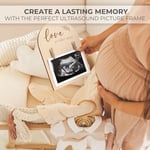 KIBAGA Güzel Ahşap Ultrason Resim Çerçevesi - Şık Çift Taraflı İşaret Hamileliğinizi veya Bebeğinizin Doğumunu Duyurmak İçin Mükemmel - Sevimli Kreş Dekoru Sonogram Fotoğraf Çerçevesi ve İlk Kez Annel