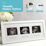 Pearhead 87038 Trimester Sonogram Frame Deluxe, fotoğraf çerçevesi için üç Ultraschallaufnahmen, beyaz