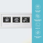Pearhead 87038 Trimester Sonogram Frame Deluxe, fotoğraf çerçevesi için üç Ultraschallaufnahmen, beyaz
