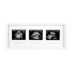 Pearhead 87038 Trimester Sonogram Frame Deluxe, fotoğraf çerçevesi için üç Ultraschallaufnahmen, beyaz