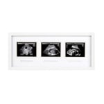 Pearhead 87038 Trimester Sonogram Frame Deluxe, fotoğraf çerçevesi için üç Ultraschallaufnahmen, beyaz