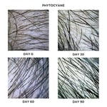 Phyto Phytocyane Densifying Treatment Serum 12 Ampul