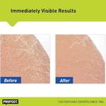 Profoot Argan Yağlı Kokusuz Nemlendirici Ayak Kremi 454GR