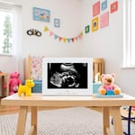 Sonogram Resim Çerçevesi Hamilelik Hatırası, Yakında Kız Bebek veya Erkek Bebek Olacak Cinsiyetsiz Çocuk Odası Dekoru