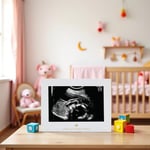 Sonogram Resim Çerçevesi Hamilelik Hatırası, Yakında Kız Bebek veya Erkek Bebek Olacak Cinsiyetsiz Çocuk Odası Dekoru