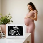 Sonogram Resim Çerçevesi Hamilelik Hatırası, Yakında Kız Bebek veya Erkek Bebek Olacak Cinsiyetsiz Çocuk Odası Dekoru