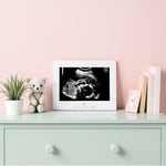 Sonogram Resim Çerçevesi Hamilelik Hatırası, Yakında Kız Bebek veya Erkek Bebek Olacak Cinsiyetsiz Çocuk Odası Dekoru