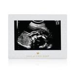 Sonogram Resim Çerçevesi Hamilelik Hatırası, Yakında Kız Bebek veya Erkek Bebek Olacak Cinsiyetsiz Çocuk Odası Dekoru