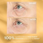 StriVectin TL HYPERLIFT EYE INSTANT EYE FIX 10 ml 1 Paket (1 x 1 Adet)