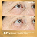 StriVectin TL HYPERLIFT EYE INSTANT EYE FIX 10 ml 1 Paket (1 x 1 Adet)