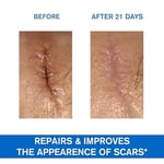 Uriage Bariederm Repairing Cica-Cream Yıpranmış Ciltler için Bakım Kremi 40ml