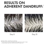 VICHY Dercos Anti Dandruff Kuru Saçlar İçin Kepek Karşıtı Şampuan 200 ml | Salisilik Asit ve Selenyum Sülfür, Kaşıntıyı Yatıştırır, Besler, Dermatolojik