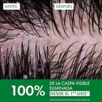 VICHY Dercos Anti Dandruff Normal Ve Yağlı Saçlar İçin Kepek Karşıtı Bakım Şampuanı 390 ml