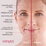 VITAYES Insant Ageback Anında Etkili Yüz Germe ve Sıkılaştırma Kremi - Göz Altı Torbaları ve Kırışıklıklarında Etkili Yüz Bakım Kremi - 15 ml - Seçenekler: 7ml, 15ml