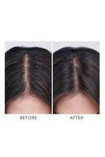 oily-scalp-treatment-for-oily-imbalanc--767e3.jpg