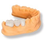 Alias Dental Temp MHF Reçine - 0.5KG