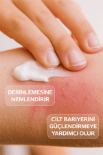Atocare Vücut Kremi Çok Kuru Ve Atopik Ciltler Için Yoğun Nemlendirici Bebek Çocuk Yetişkin 150 ml