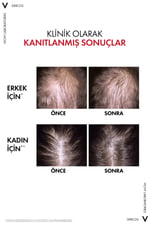 Dercos R.E.G.E.N. Booster Yenilikçi Saç Dökülmesine Karşı Bakım Serumu 90 ml