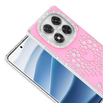 Xiaomi Redmi Note 14 Pro 4G Kılıf Damla Taşlı Zore Rivas Sert PC Kapak