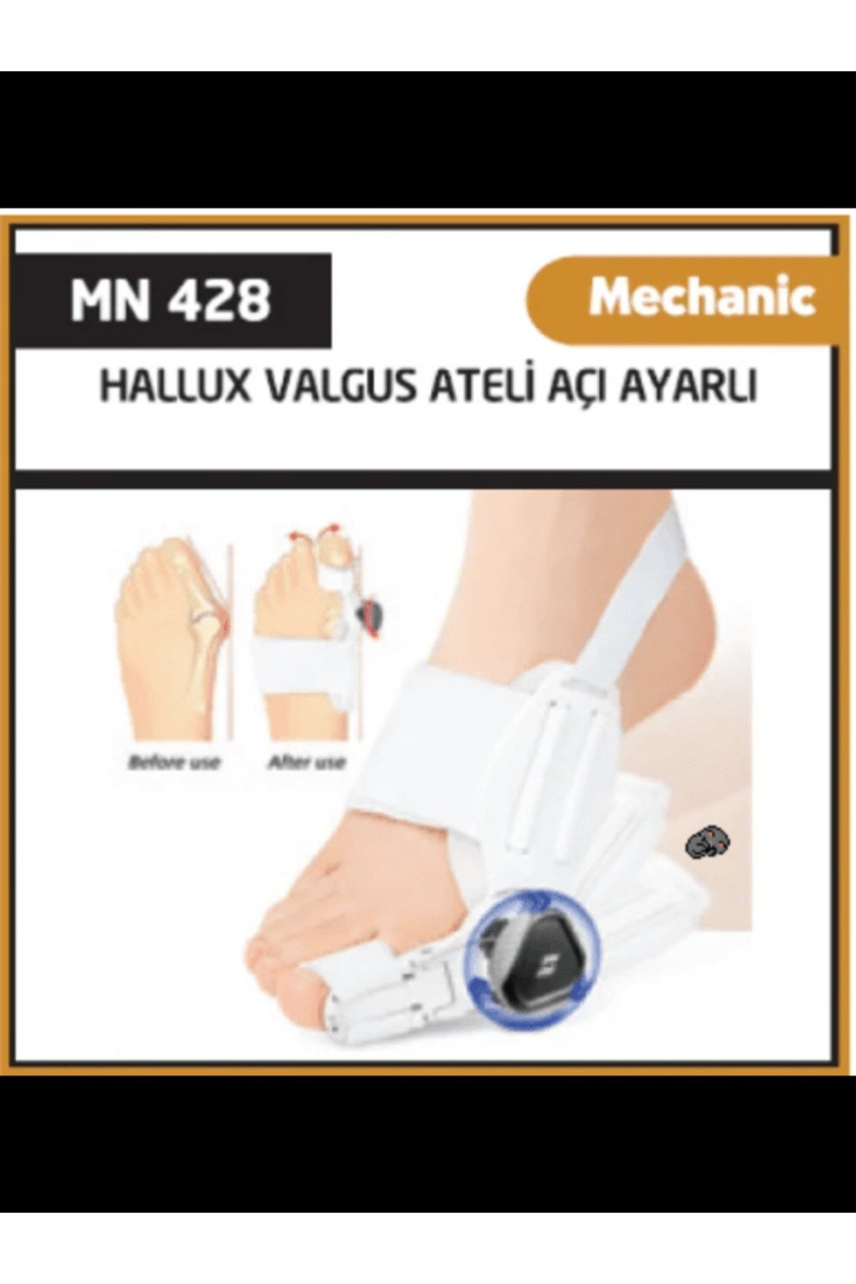Hallux Valgus Açı Ayarlı Gece Ateli Ayak Baş Parmak Kemik Çıkıntısı Düzeltici Aparat Atel