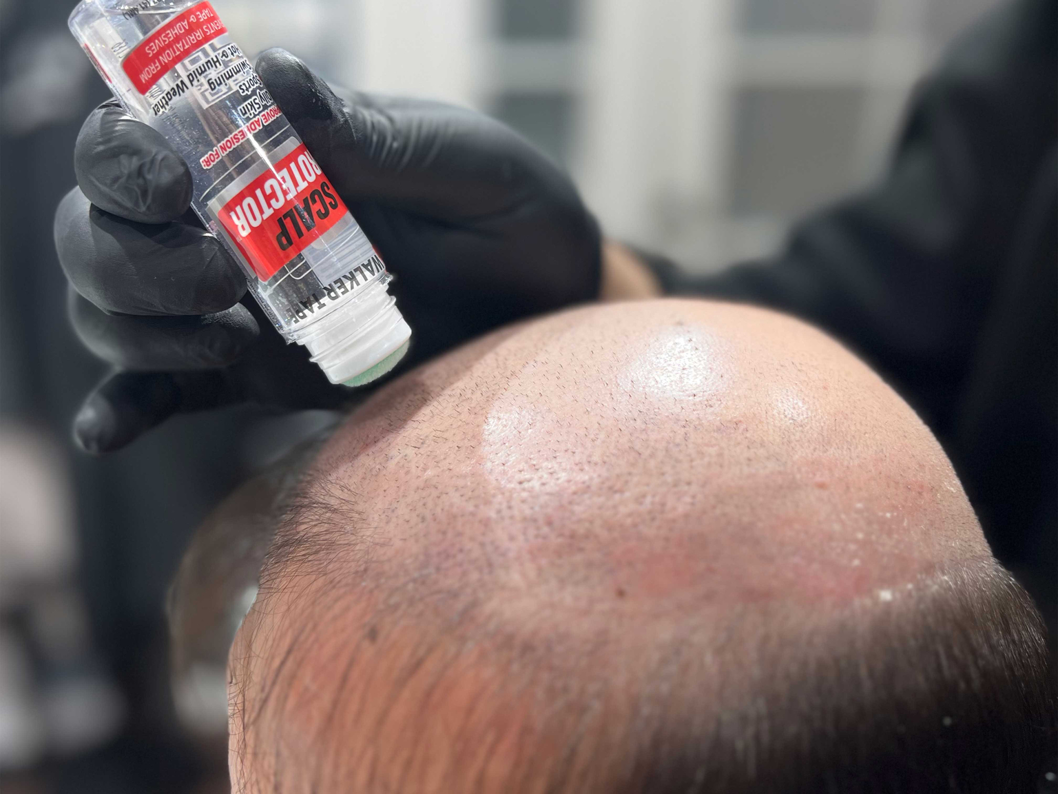 2. Scalp Protector Uygulama Şekli