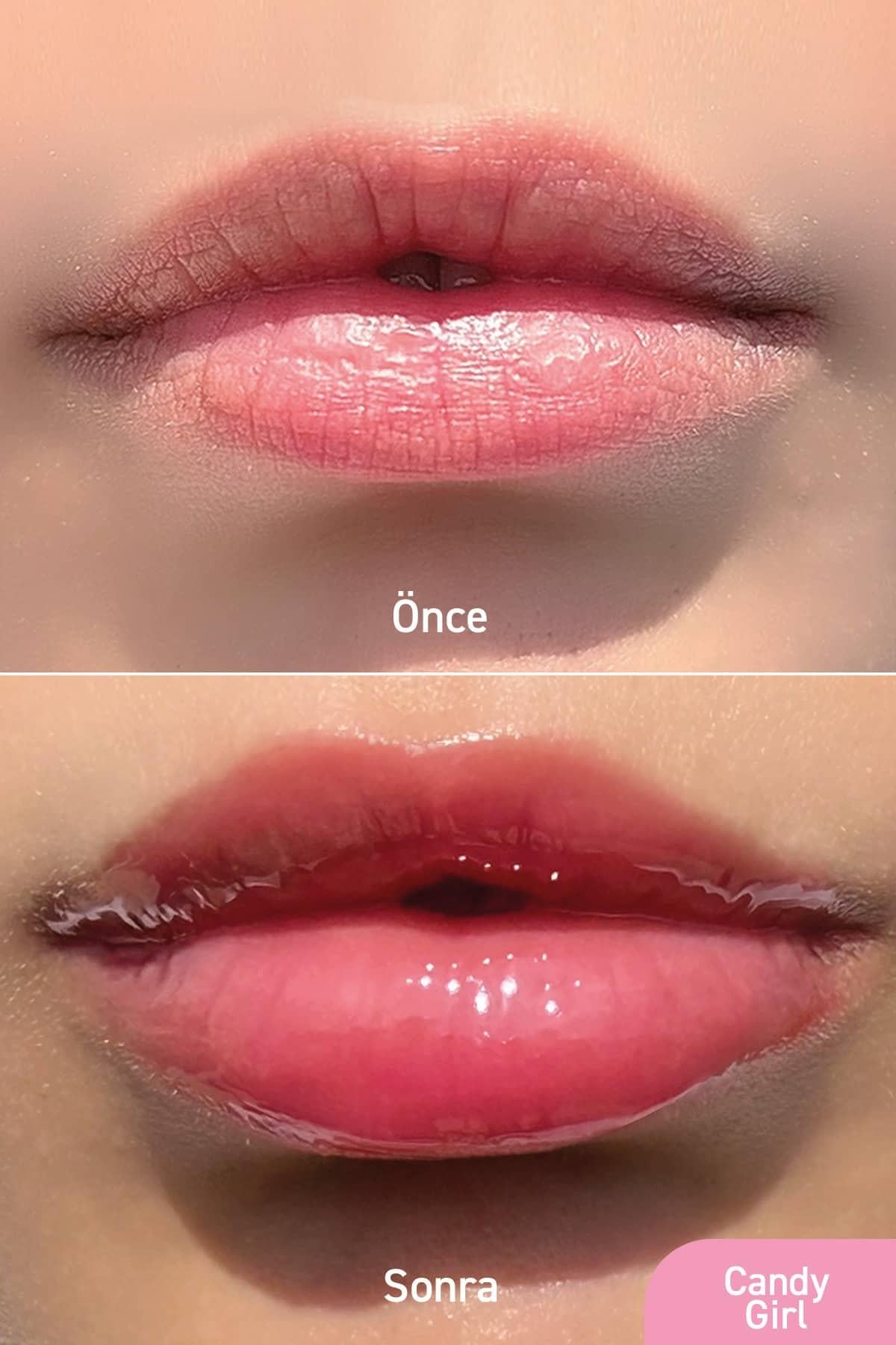 Parlatıcı, Dolgunlaştırıcı, Onarıcı Vegan Dudak Balmı, Pamuk Şeker Aromalı 10 ml