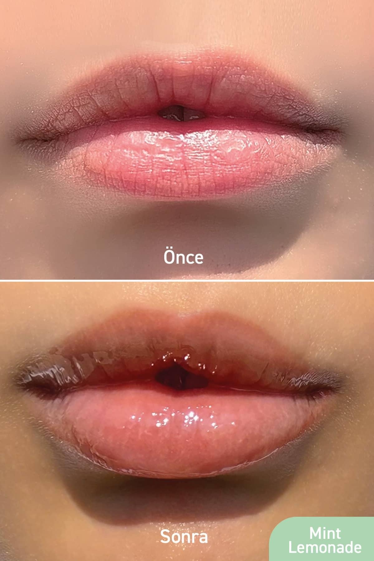 Parlatıcı, Dolgunlaştırıcı, Onarıcı Vegan Dudak Balmı, Limonata Aromalı 10 ml