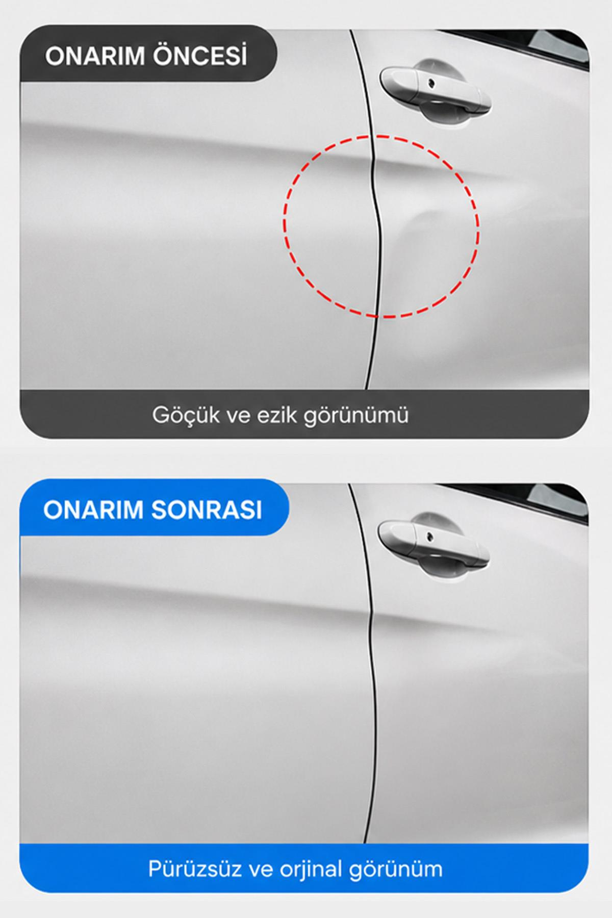 Göçük Giderici Vantuz Büyük Boy Araç Kaporta Düzeltme Vakum Aparatı Güçlü Çektirme