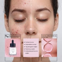 S.O.S Sebum Dengeleyici Serum