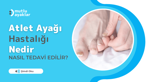 Atlet Ayağına Hastalığı