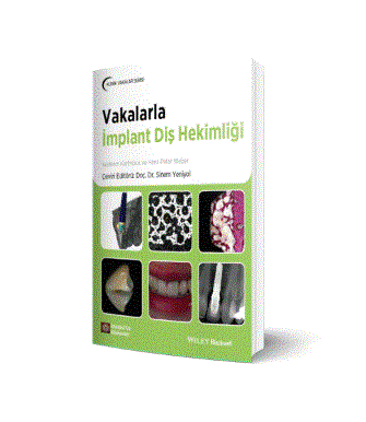 Vakalarla İmplant Diş Hekimliği